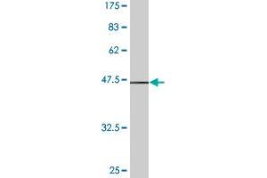 Western Blot detection against Immunogen (37. (Stathmin 1 antibody  (AA 40-149))