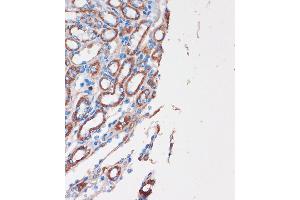 Immunohistochemistry of paraffin-embedded Mouse kidney using CHDH Rabbit pAb (ABIN7266341) at dilution of 1:100 (40x lens). (CHDH antibody  (AA 245-594))