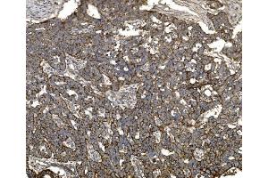 IHC analysis of Claudin 3/CLDN3 using anti-Claudin 3/CLDN3 antibody (ABIN7599626).