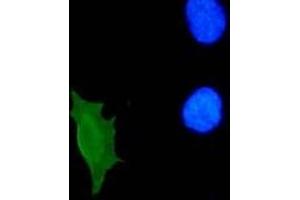 Immunofluorescence (IF) image for anti-Human Papilloma Virus 11 E7 (HPV-11 E7) (AA 36-70) antibody (ABIN781777) (Human Papilloma Virus 11 E7 (HPV-11 E7) (AA 36-70) antibody)
