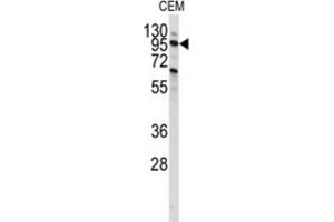 Western Blotting (WB) image for anti-Phosphoinositide-3-Kinase, Class 3 (PIK3C3) antibody (ABIN3000300) (PIK3C3 antibody)