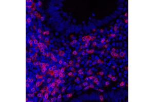 Immunofluorescence (IF) image for anti-CD3 epsilon (CD3E) (AA 157-207) antibody (ABIN7454035) (Recombinant CD3 epsilon antibody  (AA 157-207))