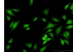 Immunofluorescence of purified MaxPab antibody to FES on HeLa cell. (FES antibody  (AA 1-822))