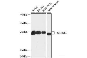 Western blot analysis of extracts of various cell lines using MESDC2 Polyclonal Antibody at dilution of 1:3000. (MESDC2 antibody)