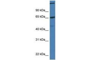 Image no. 1 for anti-ST6 (Alpha-N-Acetyl-Neuraminyl-2,3-beta-Galactosyl-1,3)-N-Acetylgalactosaminide alpha-2,6-Sialyltransferase 1 (ST6GALNAC1) (AA 450-499) antibody (ABIN6747275) (ST6GALNAC1 antibody  (AA 450-499))