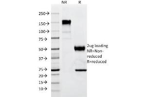 SDS-PAGE Analysis Purified p57 Mouse Monoclonal Antibody (SPM308). (CDKN1C antibody)