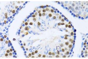Immunohistochemistry of paraffin-embedded Mouse testis using DDX46 Polyclonal Antibody at dilution of 1:100 (40x lens). (DDX46 antibody)