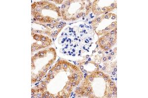 Immunohistochemical analysis of paraffin-embedded M. (BCL10 antibody  (AA 1-143))