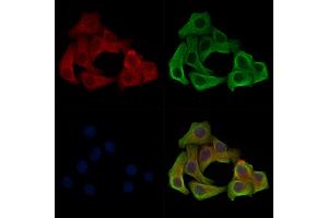 Phospho-LRP6 (Ser1420) Antibody staining Hela cells(heat shock treatment) by IF/ICC.