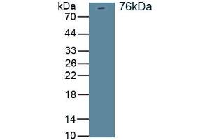 Detection of Recombinant DLG4, Rat using Polyclonal Antibody to Discs, Large Homolog 4 (DLG4) (DLG4 antibody)