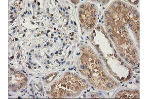 Immunohistochemical staining of paraffin-embedded Human Kidney tissue using anti-CAT mouse monoclonal antibody. (Catalase antibody)