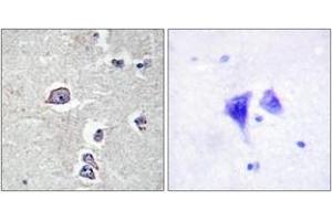 Immunohistochemistry analysis of paraffin-embedded human brain tissue, using PDGFR alpha (Ab-754) Antibody.
