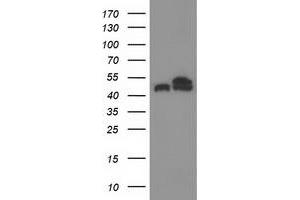 HEK293T cells were transfected with the pCMV6-ENTRY control (Left lane) or pCMV6-ENTRY TUBB4 (Right lane) cDNA for 48 hrs and lysed. (TUBB4 antibody)