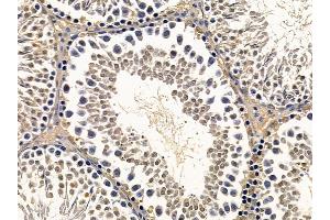 ABIN7093928 and ABIN7097972 at 1/100 staining rat testis tissue by IHC-P.