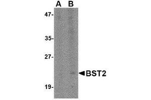 Western blot analysis of Bst2 in Daudi cell lysate with AP30169PU-N Bst2 antibody at (A) 1 and (B) 2 μg/ml. (BST2 antibody  (N-Term))