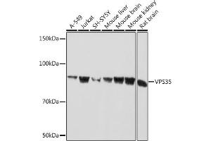 Western blot analysis of extracts of various cell lines, using VPS35 Rabbit mAb (ABIN7271276) at 1:1000 dilution. (VPS35 antibody)