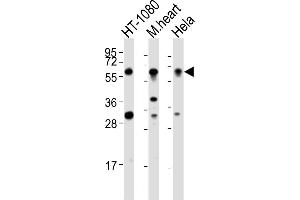 All lanes : Anti-SMYD2 Antibody (N-term) at 1:2000 dilution Lane 1: HT-1080 whole cell lysates Lane 2: mouse heart lysates Lane 3: Hela whole cell lysates Lysates/proteins at 20 μg per lane.