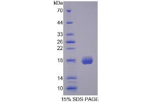 SDS-PAGE analysis of Human CFP Protein. (CFP Protein)