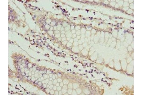 MT1G antibody  (AA 1-59)