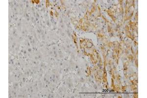 Image no. 1 for anti-CAMP Responsive Element Binding Protein 5 (CREB5) (AA 1-100) antibody (ABIN599087) (CREB5 antibody  (AA 1-100))
