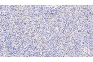 Immunohistochemistry (IHC) image for anti-Vinculin (VCL) (AA 1020-1134) antibody (ABIN7445924)
