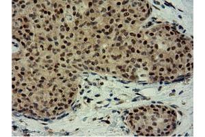 Image no. 7 for anti-EPM2A (Laforin) Interacting Protein 1 (EPM2AIP1) antibody (ABIN1498047) (EPM2AIP1 antibody)