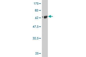Western Blot detection against Immunogen (75. (FLI1 antibody  (AA 1-452))