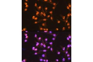 Immunofluorescence analysis of U-2 OS cells using PUMA Rabbit mAb (ABIN1678790, ABIN3018050, ABIN3018051 and ABIN7101572) at dilution of 1:100 (40x lens). (PUMA antibody)
