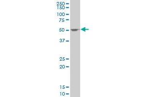 SSB polyclonal antibody (A01), Lot # FAK0060323QCS1 Western Blot analysis of SSB expression in HeLa . (SSB antibody  (AA 1-408))