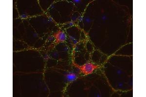 Indirect immunostaining of PFA fixed rat hippocampus neurons with anti-HCN 1 (dilution 1 : 500; red) and mouse anti-synapsin 1 (, dilution 1 : 500; green). (HCN1 antibody  (AA 849-910))