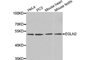 Western blot analysis of extracts of various cell lines, using EGLN2 antibody.