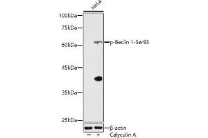 Western Blotting (WB) image for anti-Beclin 1, Autophagy Related (BECN1) (pSer93) antibody (ABIN7265873)