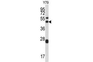 Image no. 1 for anti-Actin Related Protein 2/3 Complex, Subunit 1A, 41kDa (ARPC1A) (Middle Region) antibody (ABIN452761) (ARPC1A antibody  (Middle Region))