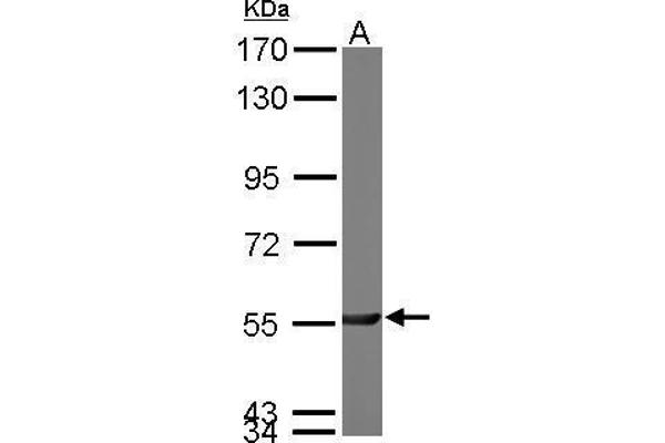 Phosphoglucomutase 3 antibody