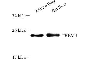 Western blot analysis of THEM4 (ABIN7075881),at dilution of 1: 600