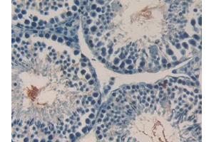DAB staining on IHC-P; Samples: Mouse Testis Tissue (RANKL antibody  (AA 92-263))