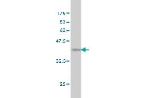 Western Blot detection against Immunogen (37. (NCOA6 antibody  (AA 1954-2063))