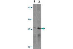 Western blot analysis of CD244 in Daudi cell lysate with CD244 polyclonal antibody  at (1) 1 and (2) 2 ug/mL.