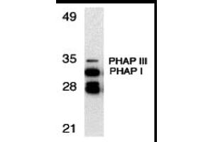 Western Blotting (WB) image for anti-Acidic (Leucine-Rich) Nuclear phosphoprotein 32 Family, Member A/B (ANP32A/ANP32B) (C-Term) antibody (ABIN1030577) (PHAP antibody  (C-Term))