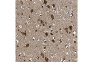 Immunohistochemical staining of human cerebral cortex with FAM69A polyclonal antibody  shows strong cytoplasmic positivity in neuronal cells.