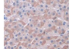 Immunohistochemistry (IHC) image for anti-Cyclin-Dependent Kinase 2 (CDK2) (AA 94-198) antibody (ABIN7434284)