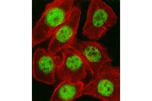 Immunofluorescence (IF) image for anti-Cyclin-Dependent Kinase Inhibitor 1A (p21, Cip1) (CDKN1A) (AA 117-146), (C-Term) antibody (ABIN657391)