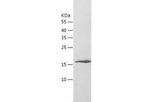 Western Blotting (WB) image for Myosin, Light Chain 12B, Regulatory (MYL12B) (AA 1-172) protein (His tag) (ABIN7284329) (MYL12B Protein (AA 1-172) (His tag))