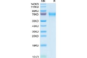 LCAT Protein (AA 25-438) (His tag)