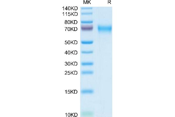 LCAT Protein (AA 25-438) (His tag)