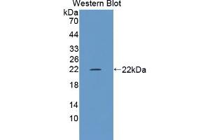 Detection of Recombinant TRPM7, Rat using Polyclonal Antibody to Transient Receptor Potential Cation Channel Subfamily M, Member 7 (TRPM7) (TRPM7 antibody  (AA 19-179))