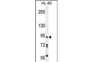 KRI1 Antibody (N-term) (ABIN654199 and ABIN2844048) western blot analysis in HL-60 cell line lysates (35 μg/lane). (KRI1 antibody  (N-Term))
