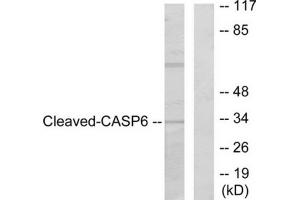 Western blot analysis of extracts from 293 cells, treated with Etoposide (25uM, 60mins), using Caspase 6 (cleaved-Asp179) antibody. (Caspase 6 antibody  (Cleaved-Asp179))