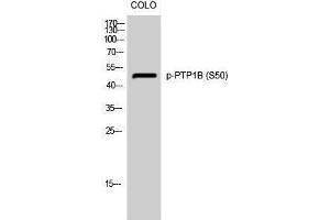 Western Blotting (WB) image for anti-Protein tyrosine Phosphatase, Non-Receptor Type 1 (PTPN1) (pSer50) antibody (ABIN3182605) (PTPN1 antibody  (pSer50))
