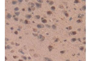 Immunohistochemistry (IHC) image for anti-Interleukin 17 Receptor D (IL17RD) (AA 356-605) antibody (ABIN7443272)